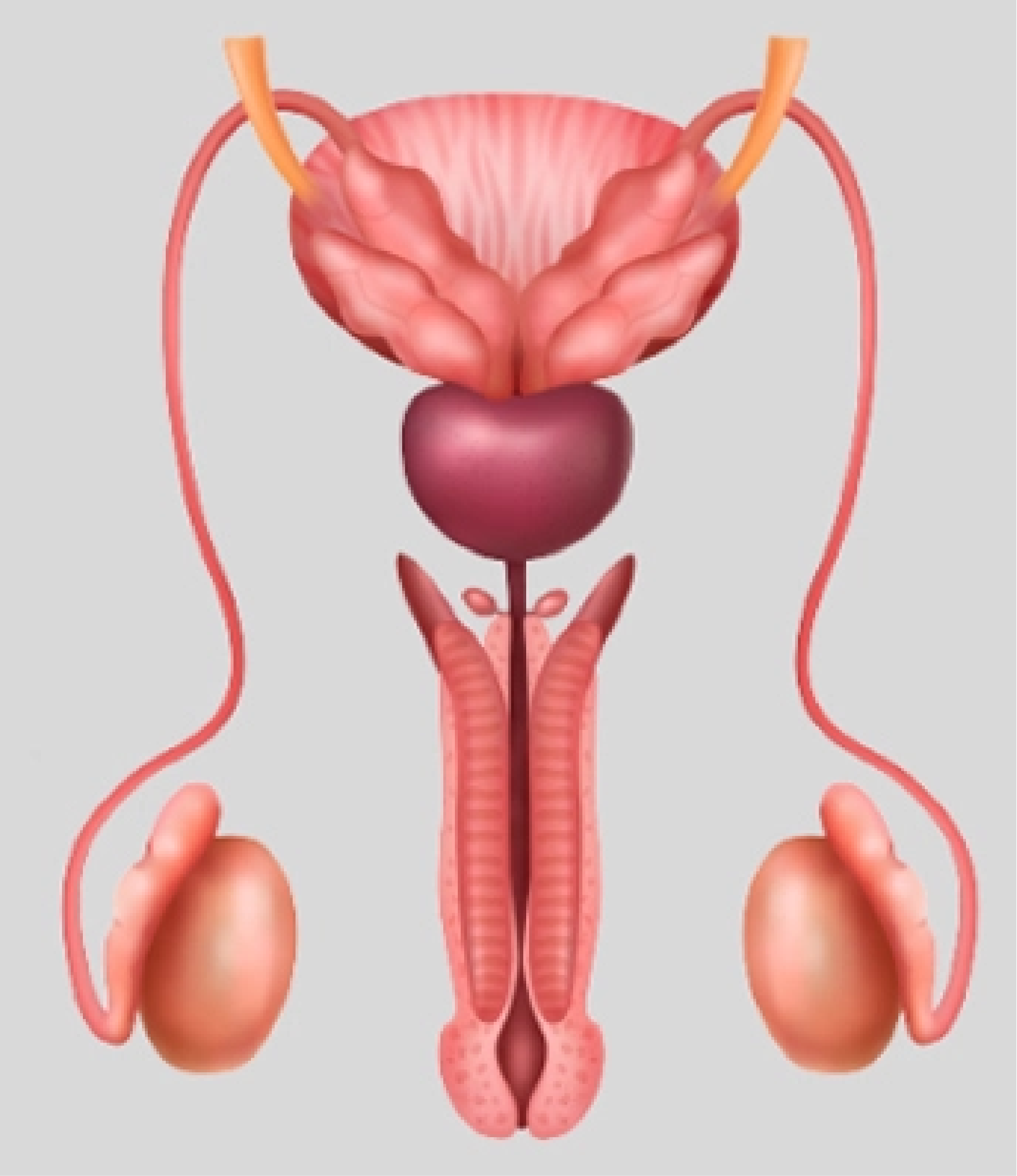 Diagram of the male urinary system anatomy, including kidneys, ureters, bladder, and urethra, highlighting the pathway and potential abnormalities.