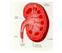 Diabetessymptoms And Complications Drugs Com